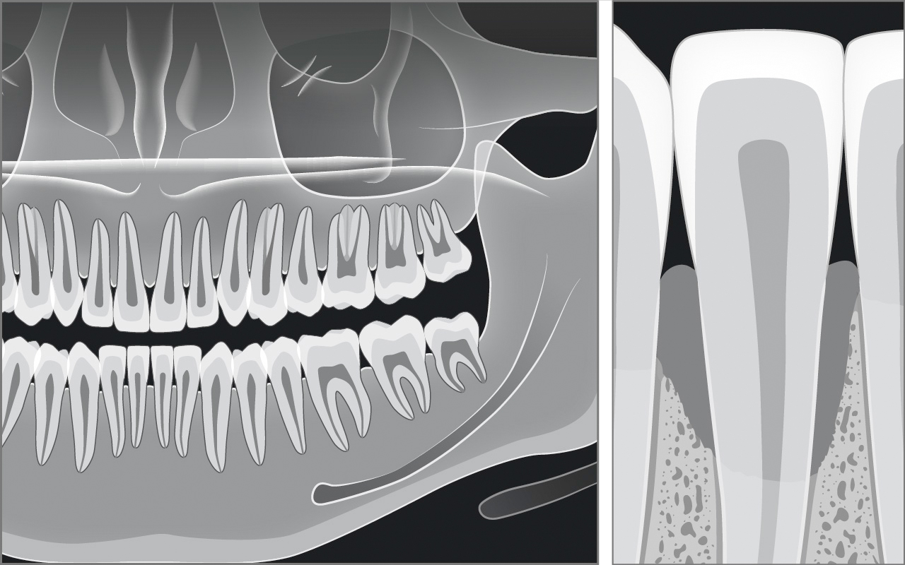 Diagnosi radiografica